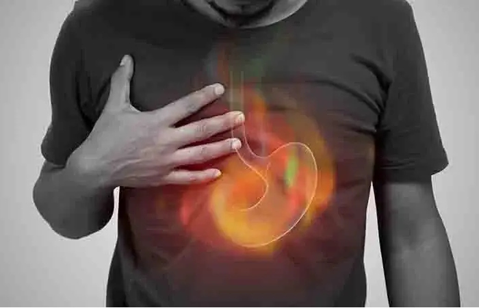 Management of Stomach Acid with Lifestyle Changes